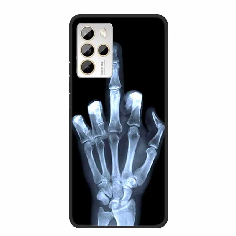 Cartoon Wolf Silicone Soft TPU Phone Case - Animal Design Protector Coque