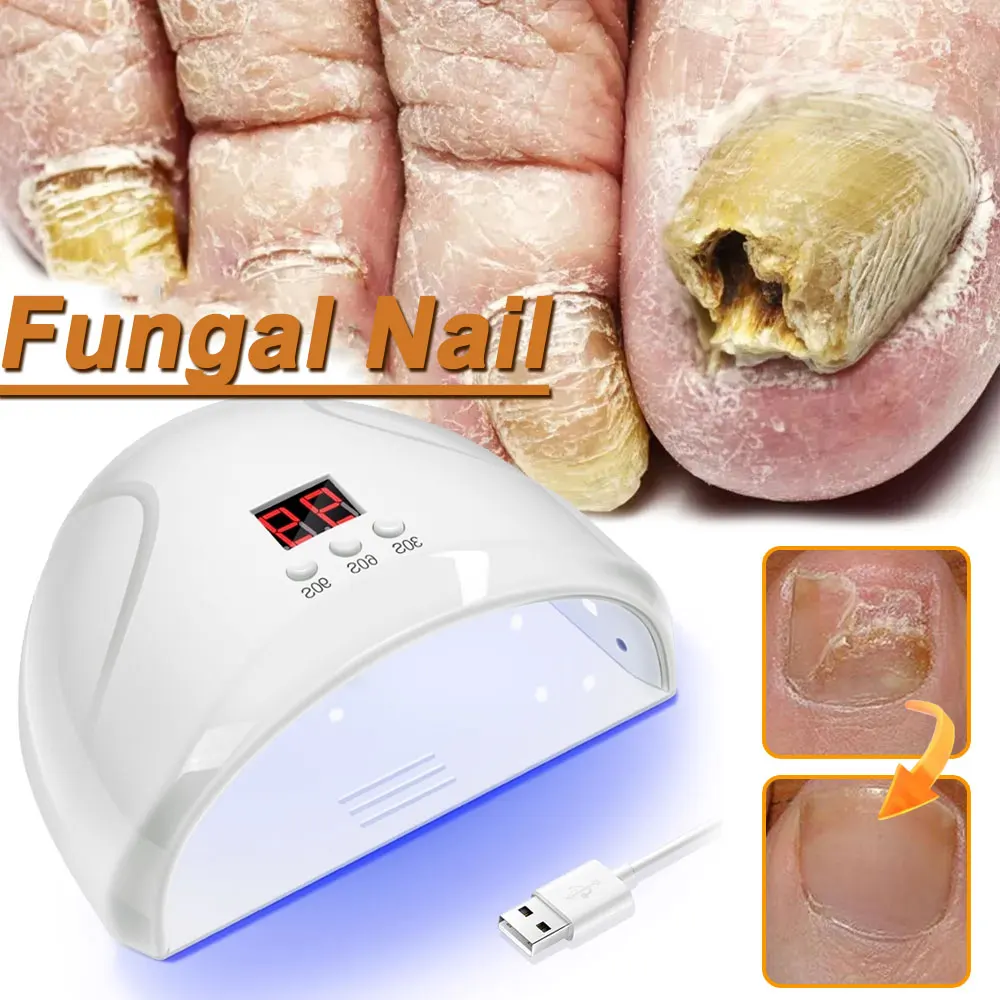 

Устройство для лазерного удаления грибковых ногтей, быстрое восстановление ногтевого грибка, онихомикоз, ногтей рук ног, лечение вросших ногтей