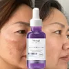 Powerful Dark Spots Remover Freckle Whitening Serum Melanin Correcting Anti Pigmentation Brighten Korean Day Night Facial Care 1
