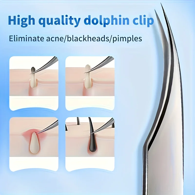 스테인리스 정밀 핀셋 눈썹 및 블랙헤드 제거기, 연한 베이지색 얼굴 잡티 청소에 적합