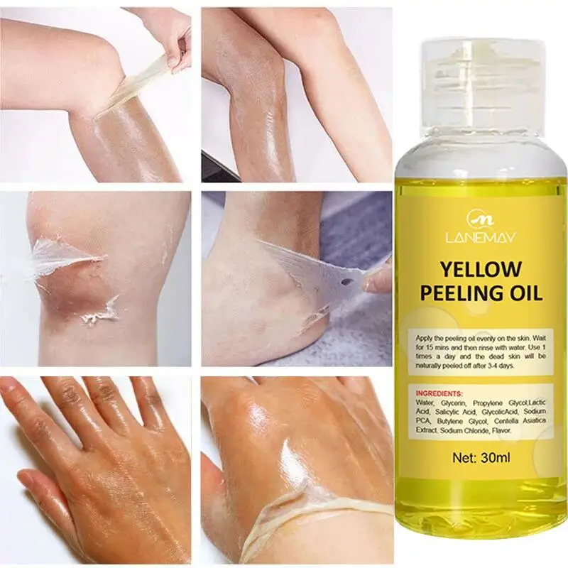 Yellow Peeling Oil Exfoliating Bleaching Dark Skin Spots Knee Finger Remove Dead Skin Melanin Whitening Brighten Body Skin Care yellow peeling oil removes exfoliating arm knee legs melanin improve dark skin effective whitening cleaning brightening body oil