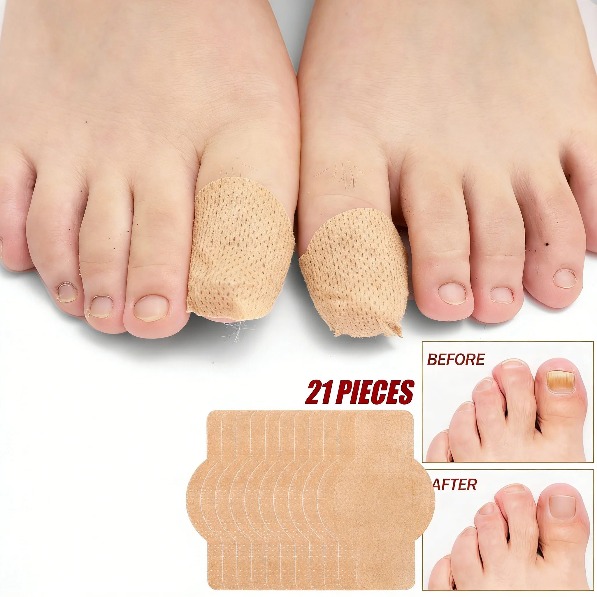 Ingrown Toenail Correction Patch Waterproof Nail Repair Tool Set_voghion.com
