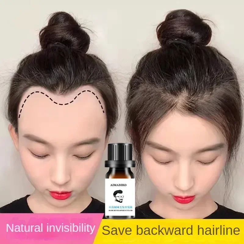 

Жидкая жидкость для быстрого роста длинных волос Sdottor для мужчин и женщин, против выпадения волос, восстановление алопеции, уход за поврежденной кожей головы