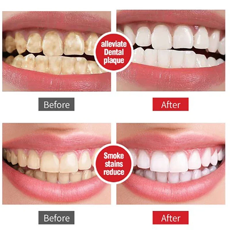 Teeth Whitening Essence Teeth Whitening Product Teeth Health Product Bamboo Charcoal Toothpaste Whiten Teeth Removing Yellow Teeth Cleaning Tooth Stain Oral Fresh Activated Carbon Tooth Care