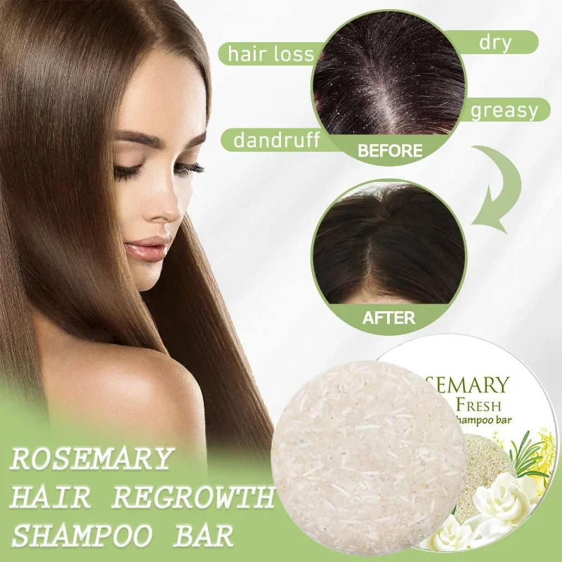 

Rosemary Hair Regrowth Shampoo Bar Anti Hair Loss Soap,Natural Organic Promotes Hair Growth,Anti-dandruff Anti-itching Wash Care