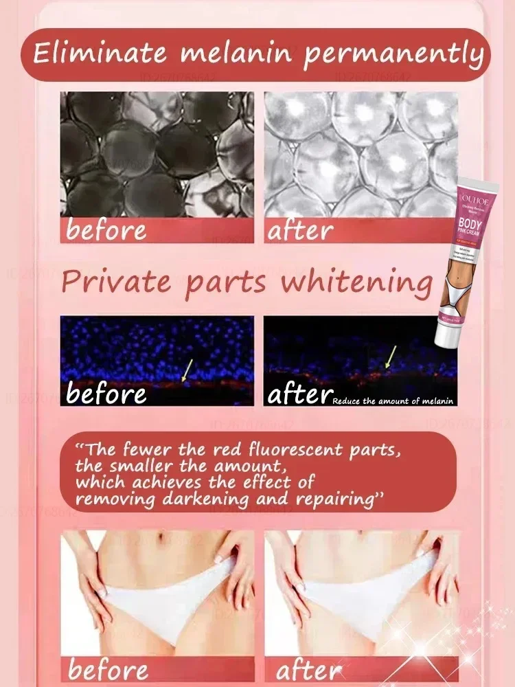 Inner Thigh Bleaching Cream Intimate Area Lightening Emulsion Butt Private Parts Brightening Cream Women Knuckles Bleach Serum 6