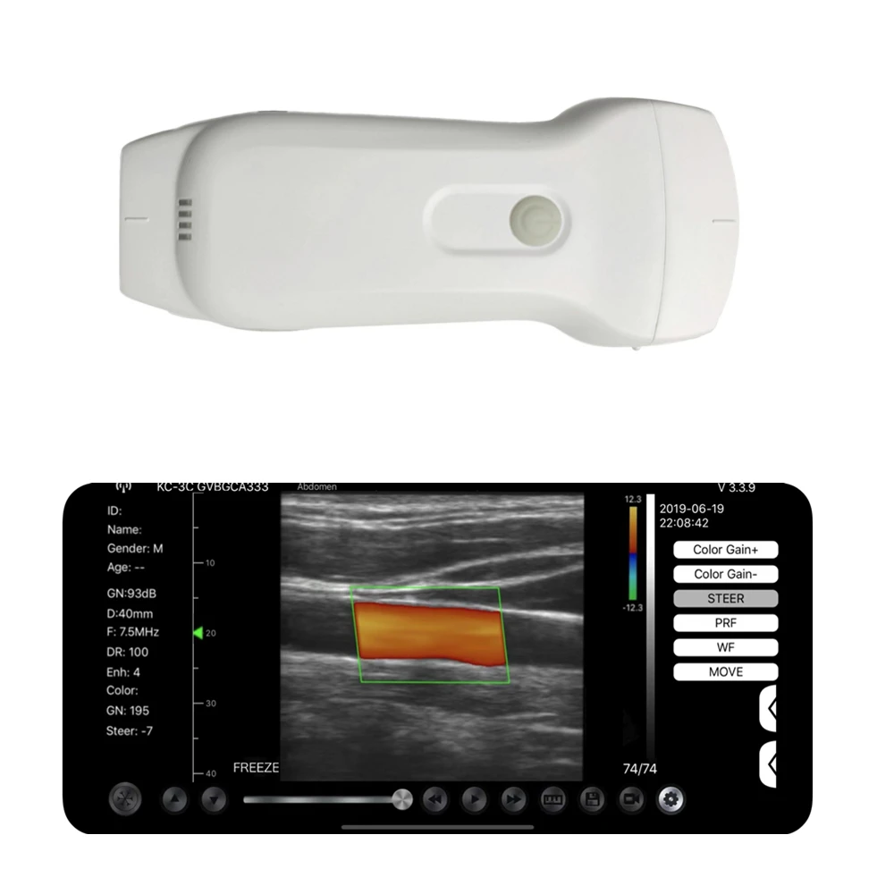 KontedPortableWirelessUltrasoundScannerProbe3In1MiniWifi