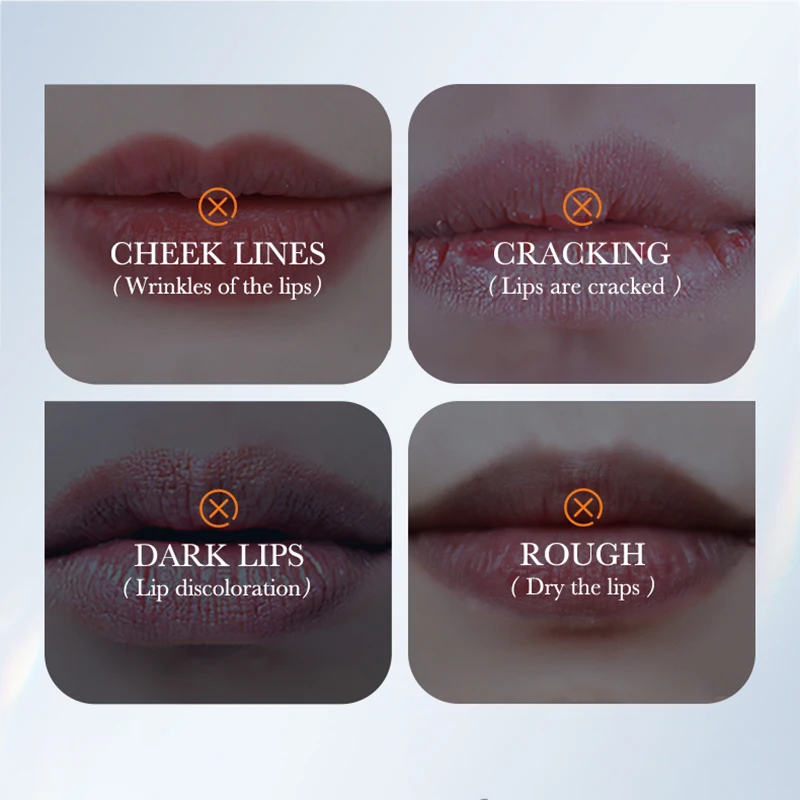 10pcs SADOER Snail Crystal Collagen Lip Mask Anti Wrinkle Nourishing Plump Lips Moisturizing Lip Patches Skin Care Products