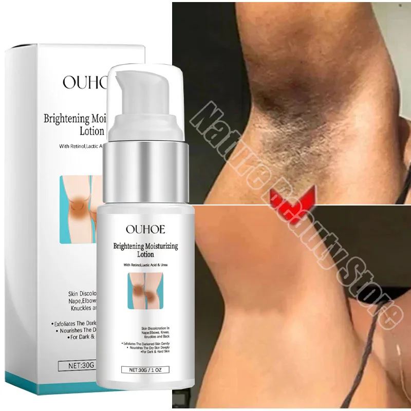 

Body Whitening Bleach Cream Brighten Underarm Elbow Knees Joint Removal Intimate Parts Dark Spots Melanin Snow Bleach Cream 30ml