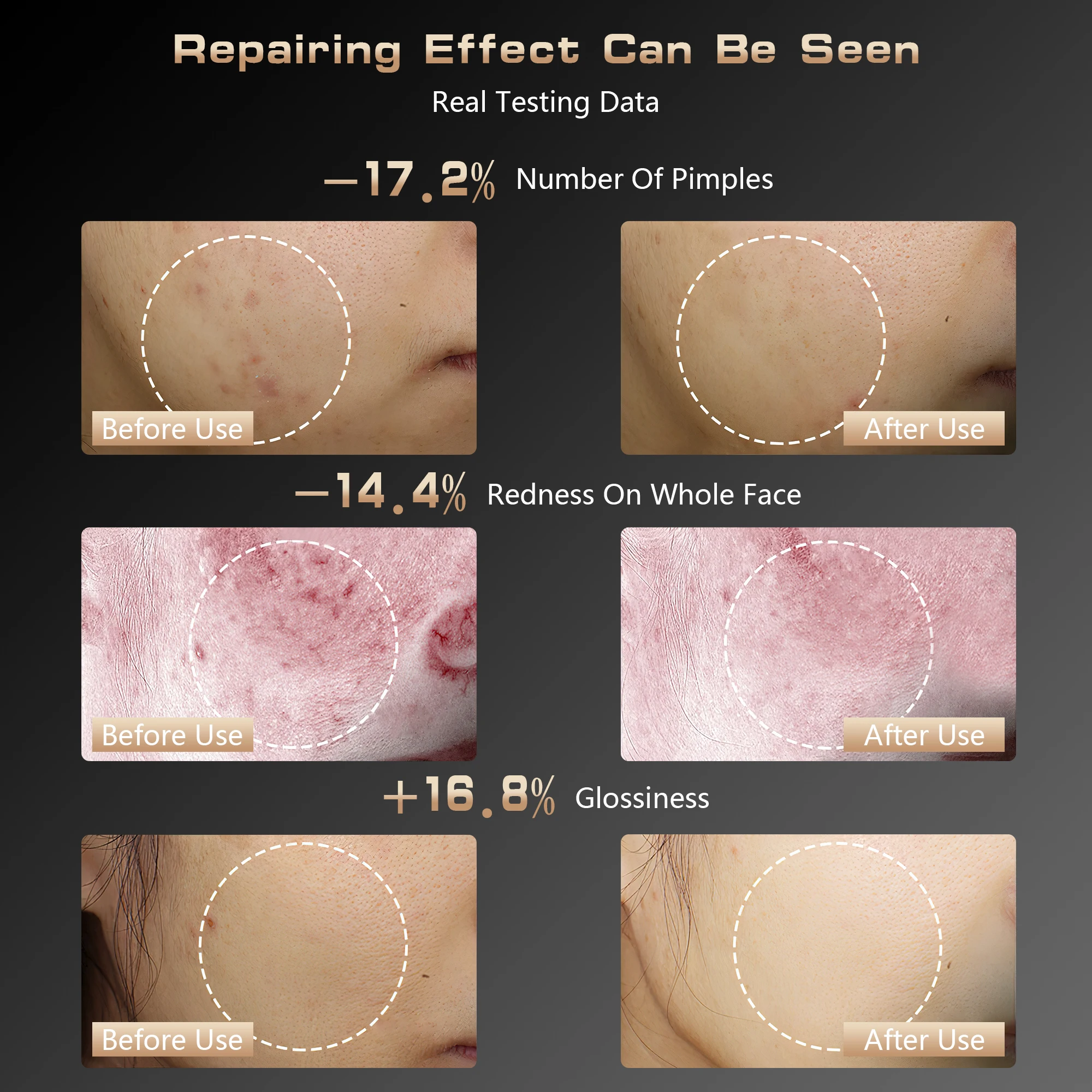 4-Wave LED Light Therapy Mask – Professional Skincare Technology at Home