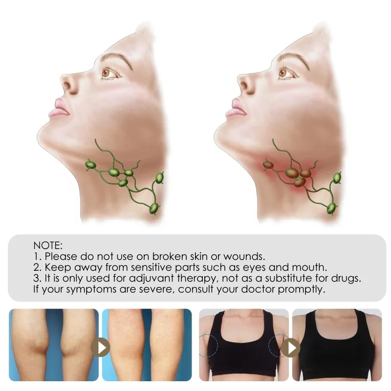 Herbal Lymphatic Detox Cream Breast Armpit Anti-Swelling Node Ointment Treatment Chest Medical Ointment Lymph Care Cream