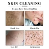 65g x2 Kojic Acid Soap Kit Facial Cleaning Pores Dirt Acne Blackhead Anti-Acne Remove Deep Cleaning Oil Control Whitening Skin 6