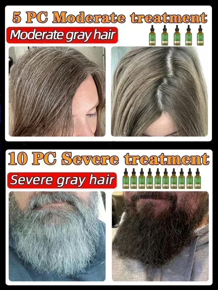 Restore Your Natural Black Hair-Guaranteed Results