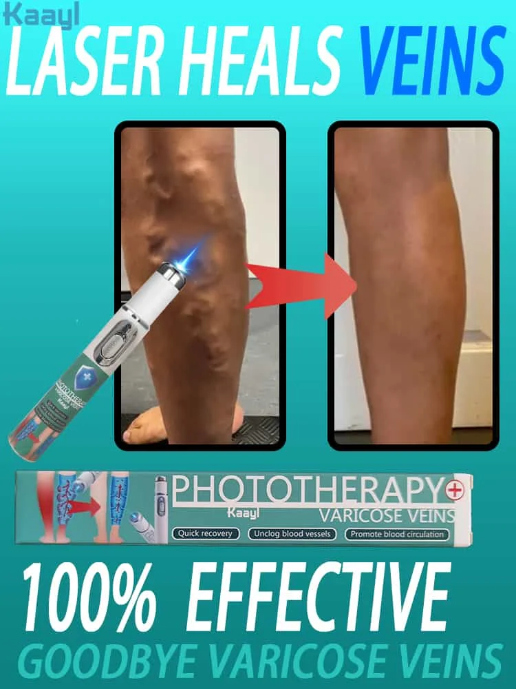 Vein Laser Hot Selling