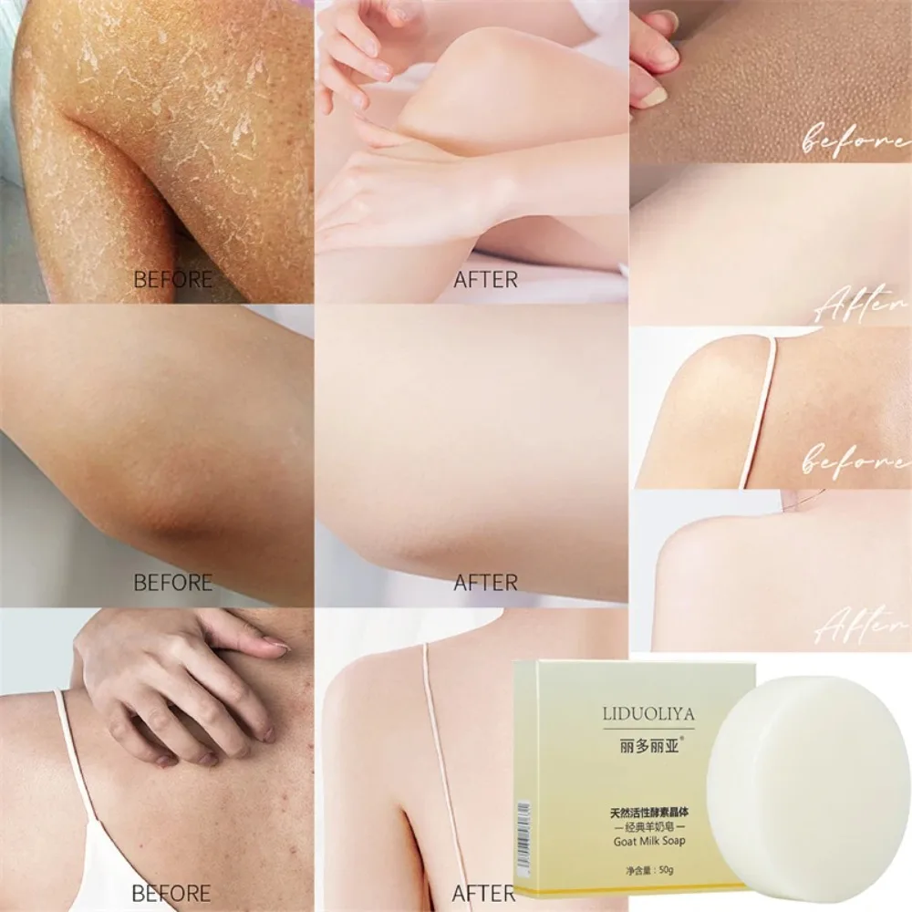 Chicken Skin Removal Body Whitening Soap Removal Dead Skin Moisturizing Bleaching Soap Body Brighten Deep Clean Goats Milk