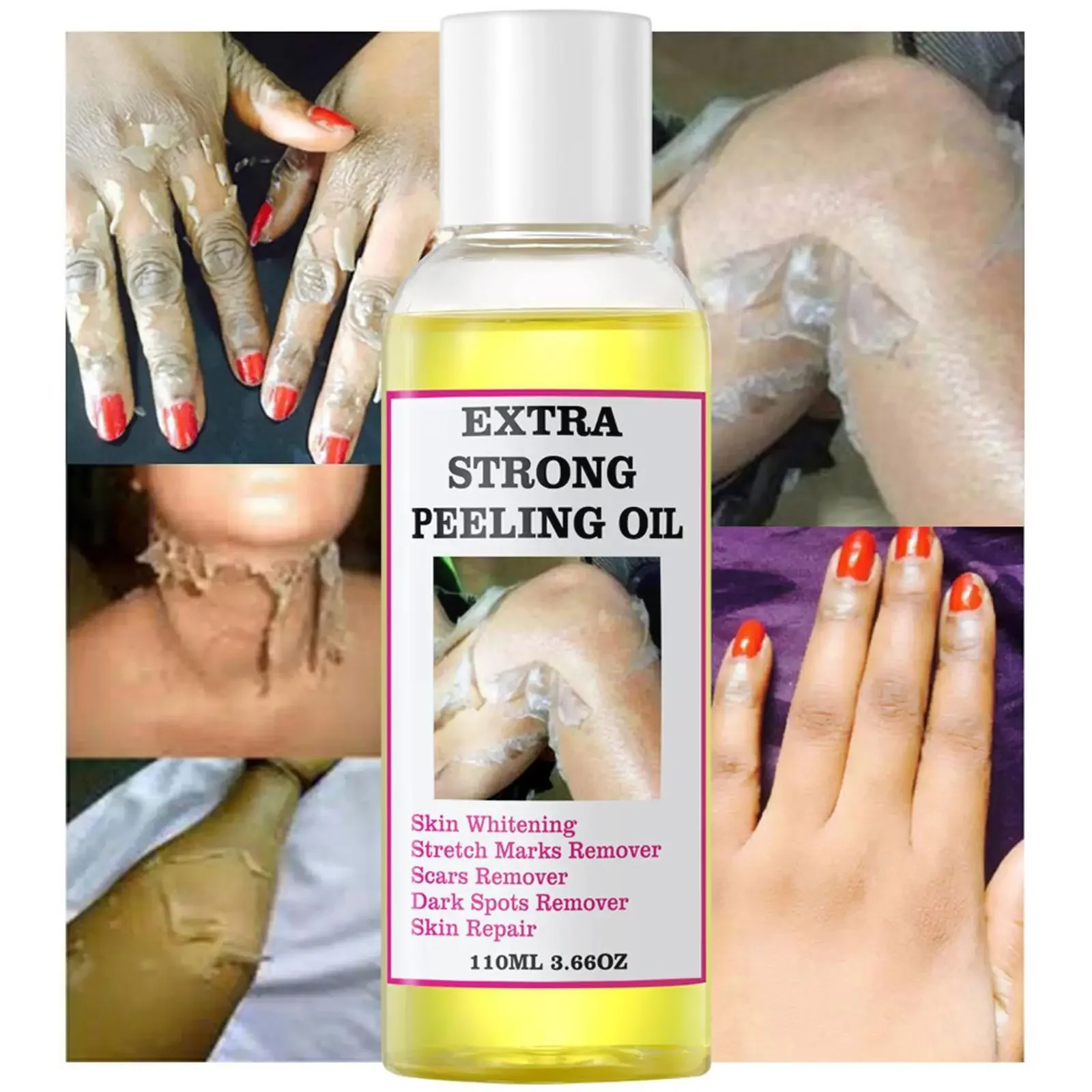 

Peeling Oil For Dark Skin Super Strength Yellow Peeling Oil Strong Peeling Oil For Brightening Moisturizing Removes Dead Skin