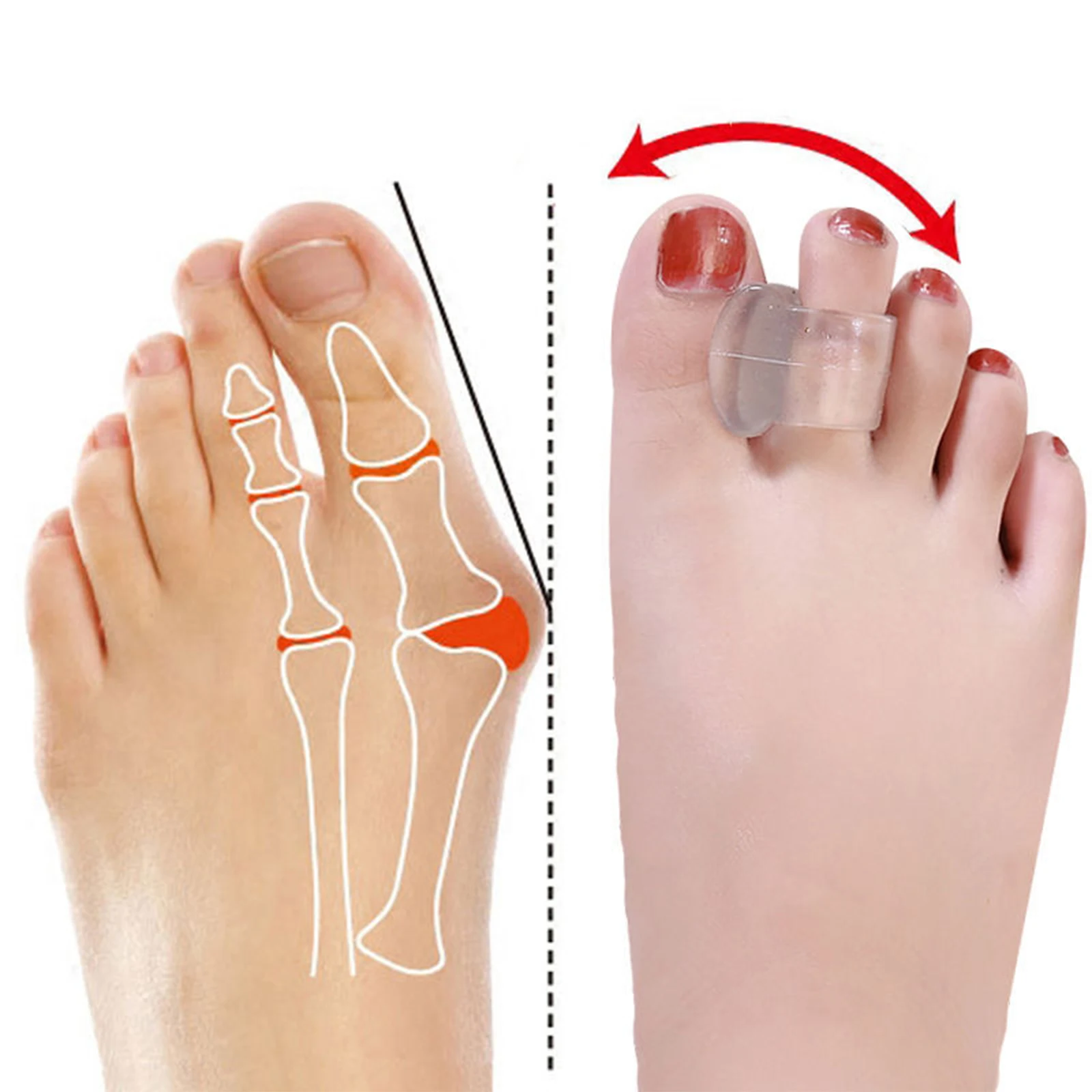 1Pair Gel Toe Separator Foot Care Tool Silicone Big Toe Bunion Straightener Valgus Hallux Bunion Protector Corrector Alignment