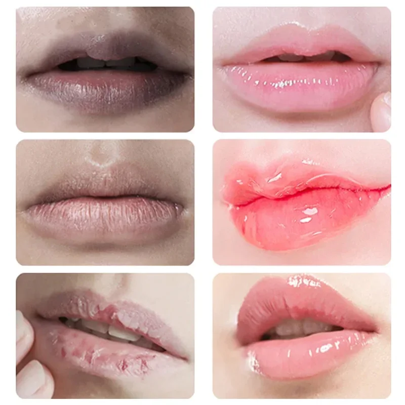 Remove Dark Aloe Lip Balm Lightening Melanin Mask Lip Gloss Oil  Exfoliating Clean Moisturizer Makeup Korean Beauty Products 3
