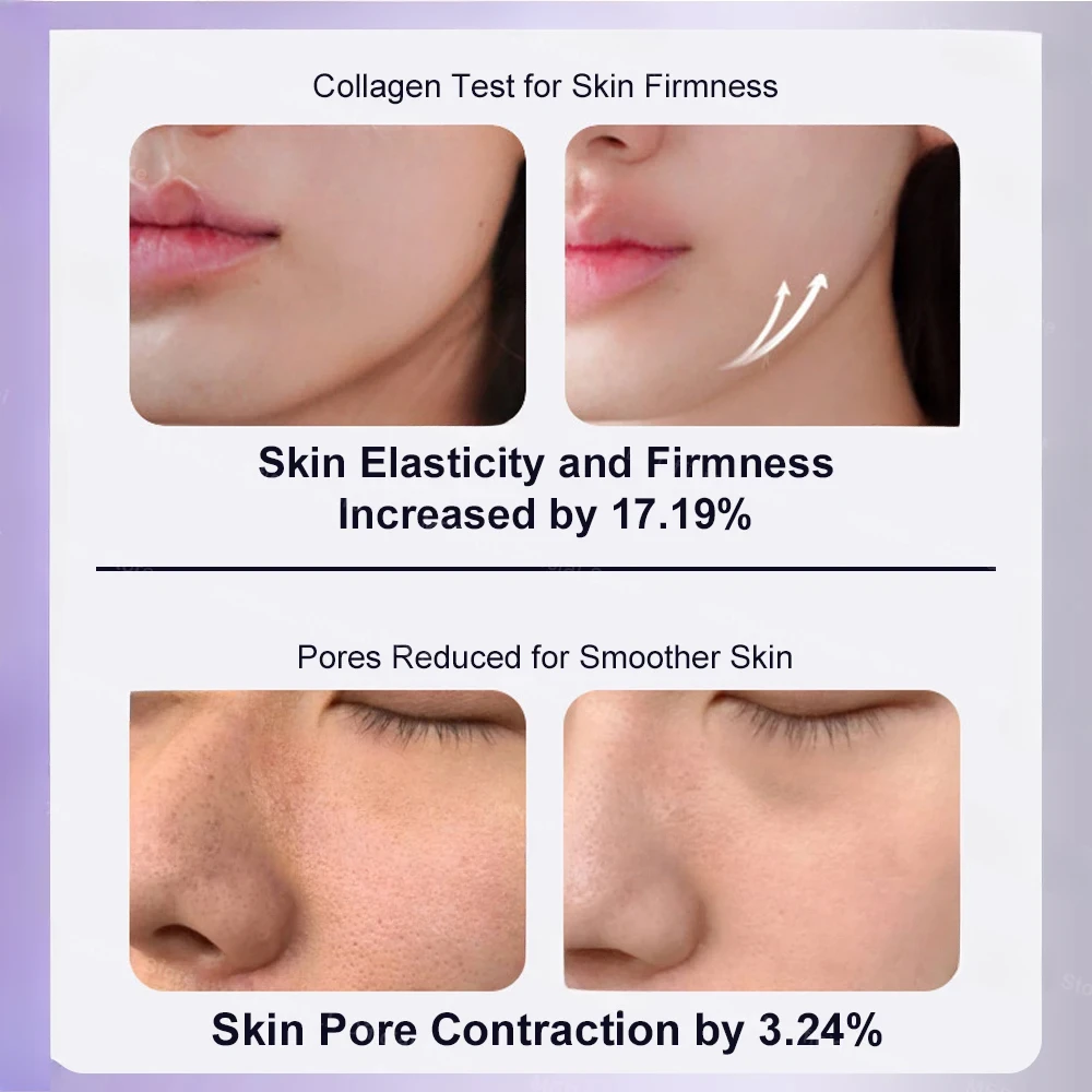 Nano Face Steamer Moisturizing Beauty Face Skin Care Electric Face Massage Red Light Skin Mouisture Tightening Facial SPA 6