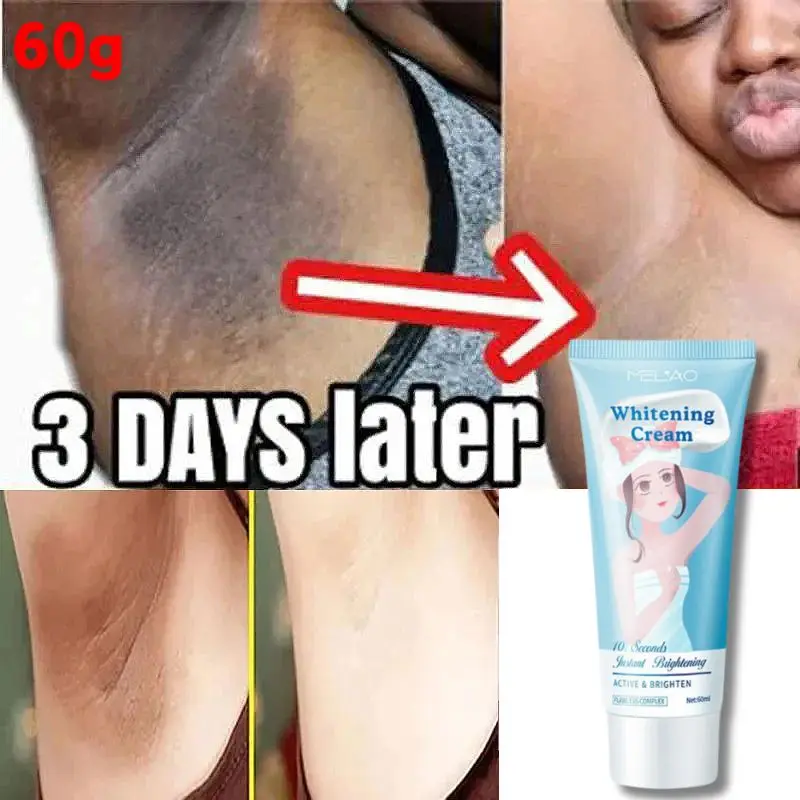 

60g Body Underarm Whitening Cream Leg Knee Private Part Brightenin Melanin Remove Black Skin Intimate Area Woman Moisturize Care
