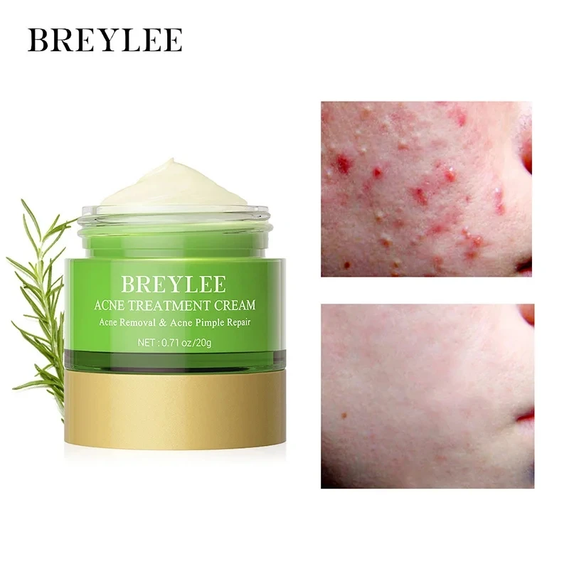 BREYLEE Facial Acne Removal Patch Acne Essence Repair face cream skin care set skin cream Facial Cream Shrink Pore Treatment Skin Care Tool