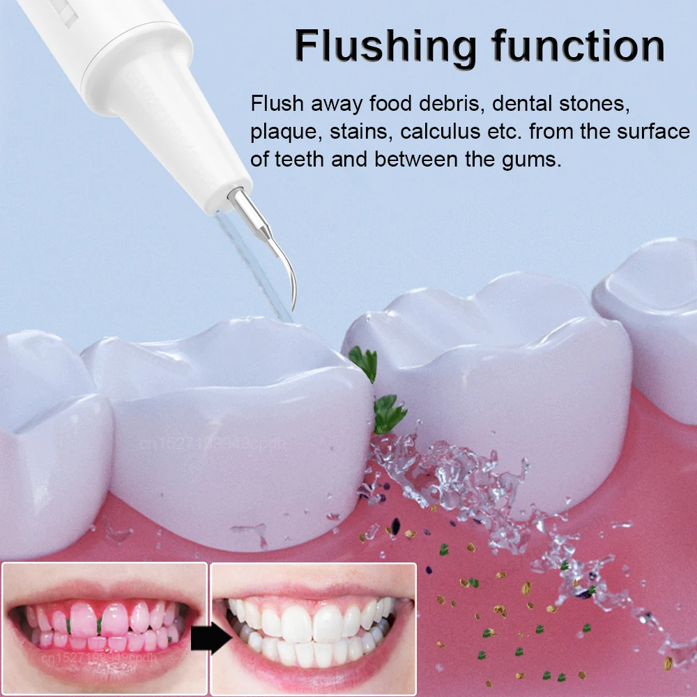 Water Flosser Portable Dental Scaling 2 in 1 Tartar Eliminator Removal Plaque Teeth Stone Stain Remover Calculus for Tooth Clean