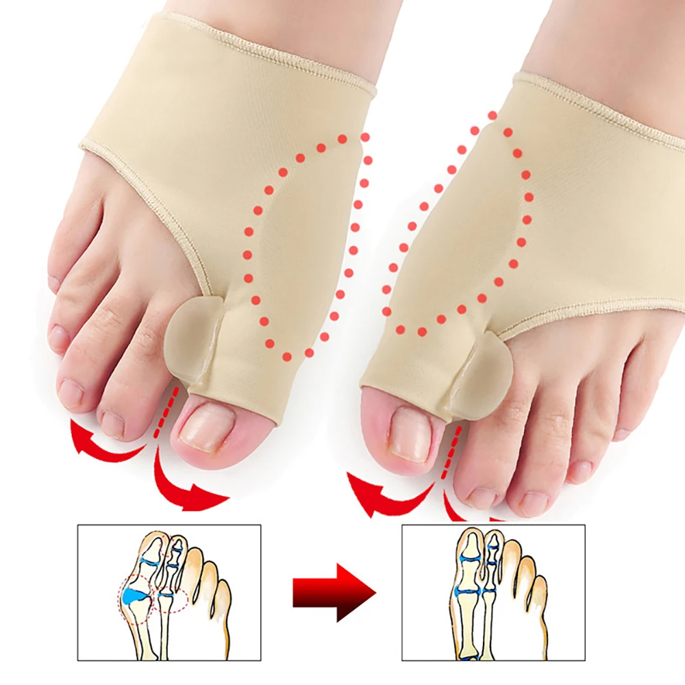 Big Bone Toe Bunion Splint Straightener Corrector Foot Pedicure Sock For Hallux Valgus Feet Care Protector Foot Care Tools 2pcs Toe Corrector