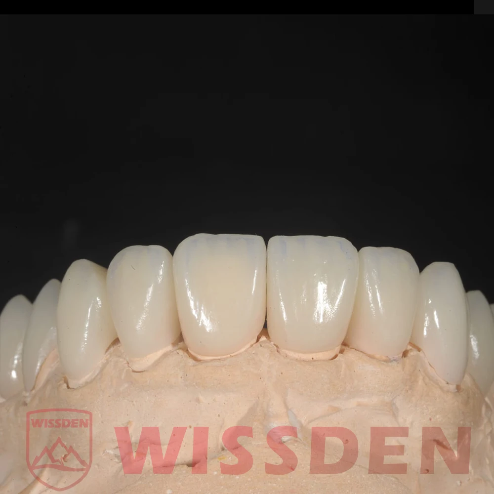 5 Pieces C14 Lithium Disilicate Blocks Cerec emax CAD Wissden Dental Glass Ceramic Cubes HT/LT CAD/CAM Manufacturer 6