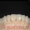 5 Pieces C14 Lithium Disilicate Blocks Cerec emax CAD Wissden Dental Glass Ceramic Cubes HT/LT CAD/CAM Manufacturer 6
