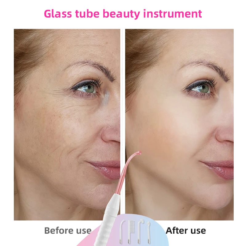 High Frequency Facial Machine Electrotherapy Wand Neon + Argon Wands Remove wrinkles Inflammation Acne Skin Care 5