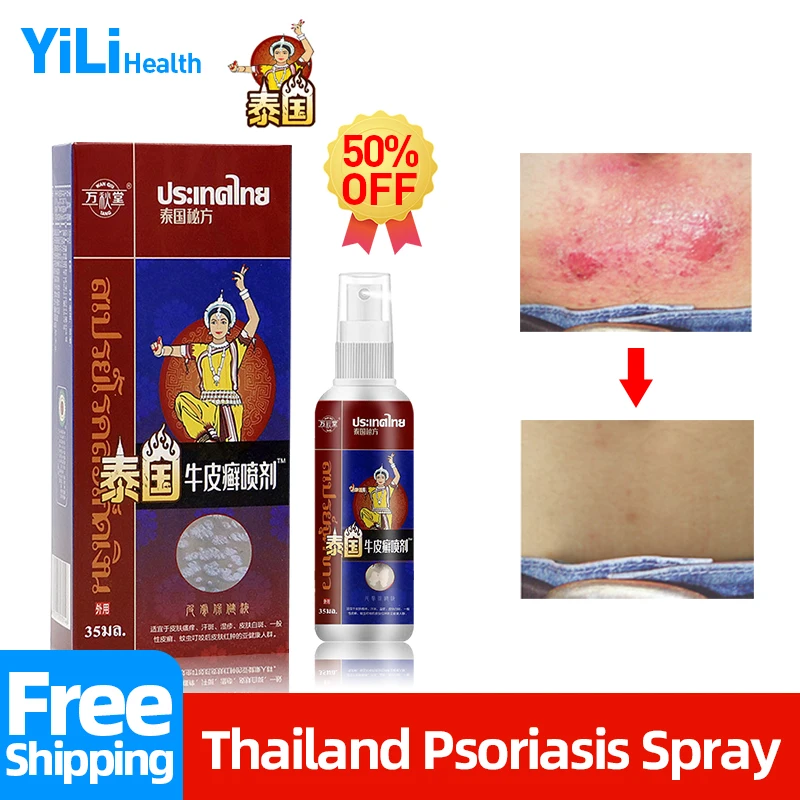 

Thai Psoriasis Spray Dermatitis Hair Antibacterial Cream Eczema Effective Treatment Skin Repair Medication Eczematoid Remover