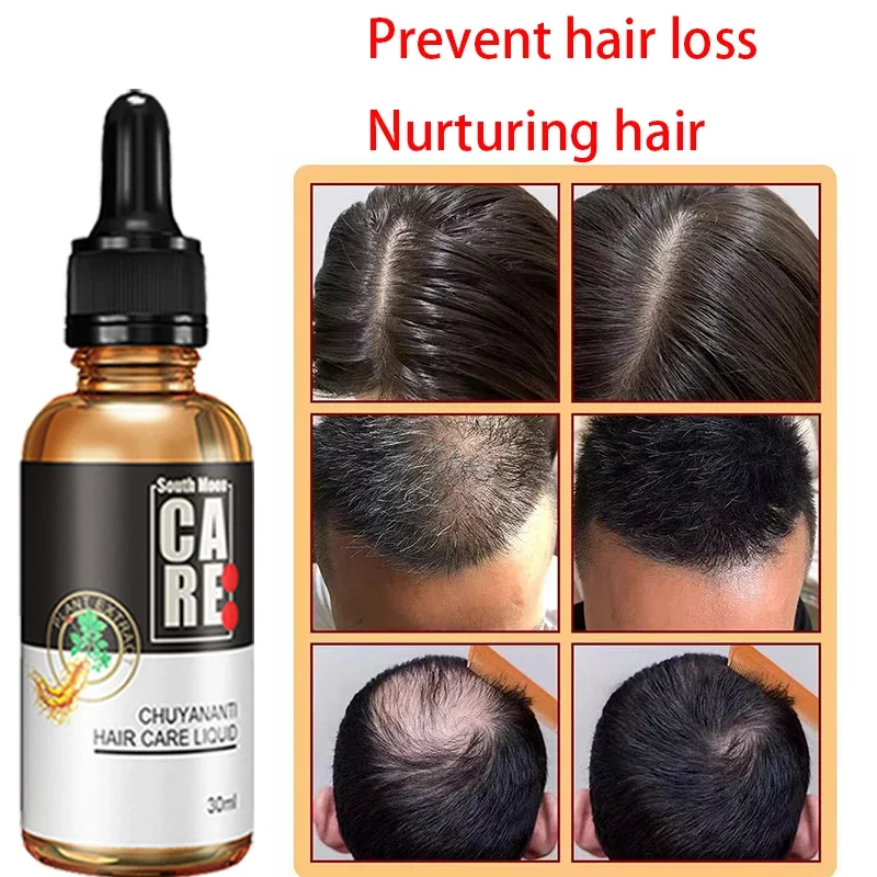 

Anti hair loss nourishing hair care hair growth nutrient solution scalp essence