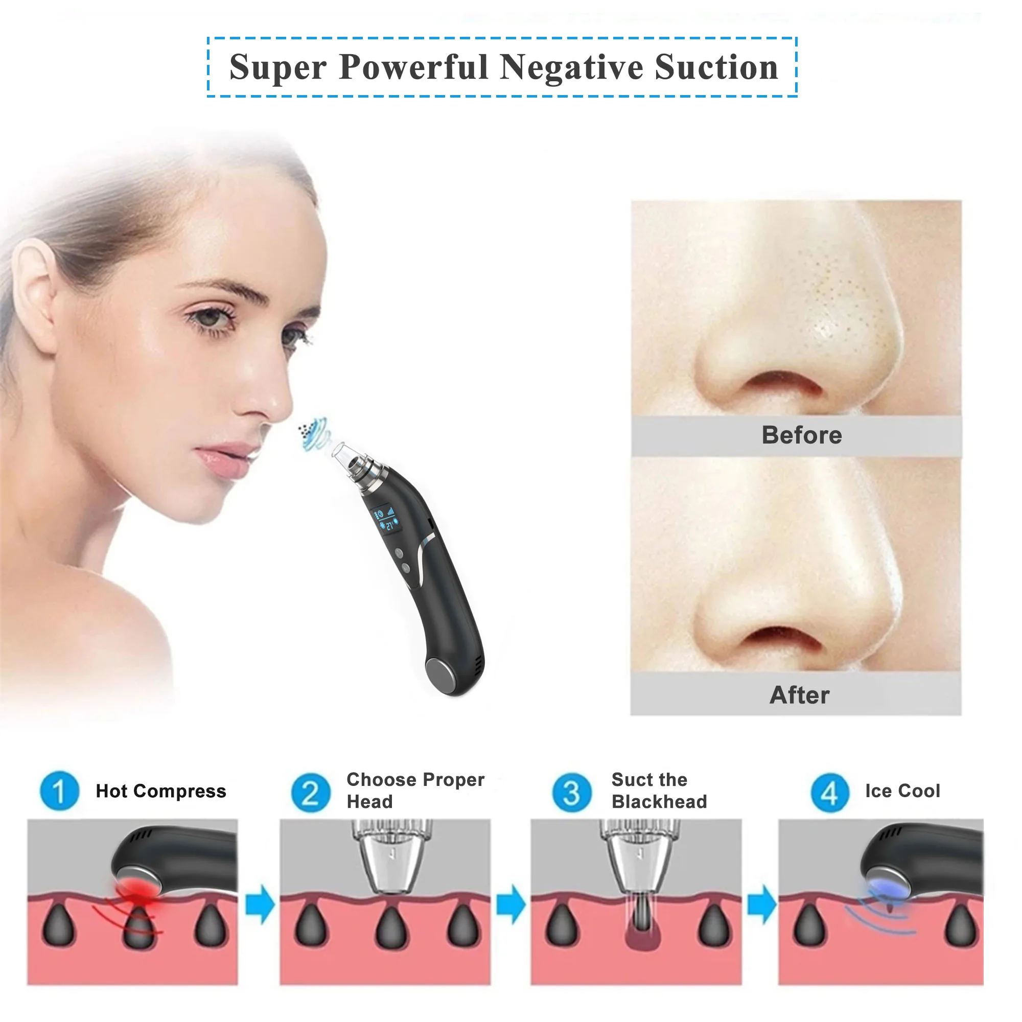 Jouet Anti-Stress Extraction De Points Noirs – Simulation Apaisante Et Ludique