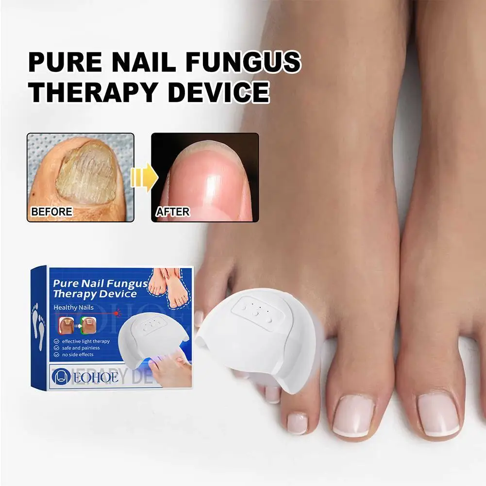 for Fungal Nail Pure Nail Photo Therapy Device for Toenail Diseases Portable Light Therapy Device Easy to Use Rechargeable easy for ecstasy pure