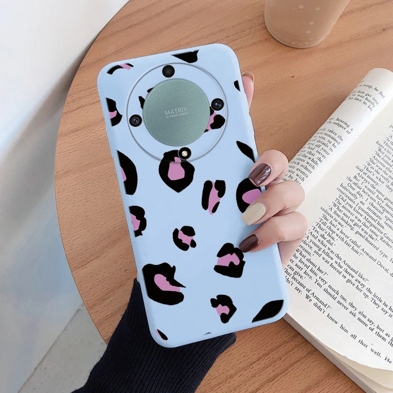 Für Honor X9a X9b X9c Magic5 6 7 Lite 5G Fall Mode Leopard Print Zurück Abdeckung Weiche TPU stoßfest Funda Marmor Textur Shell – Detail 30