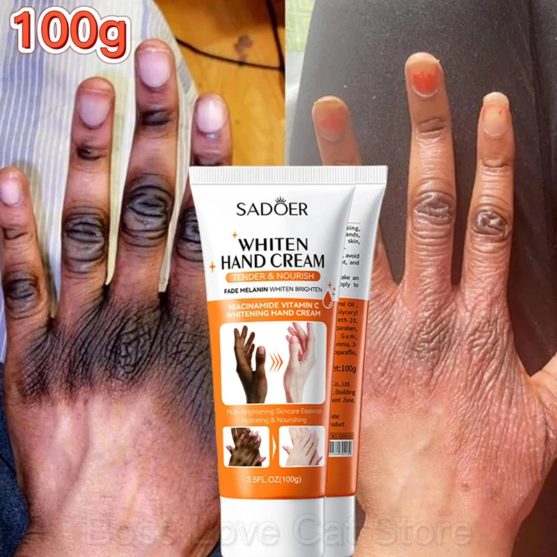 Dark Knuckles Fast Whitening Cream Melanin Removal Anti Cracking Pigmentation Correctors for Black Skin Intense Stains Remover