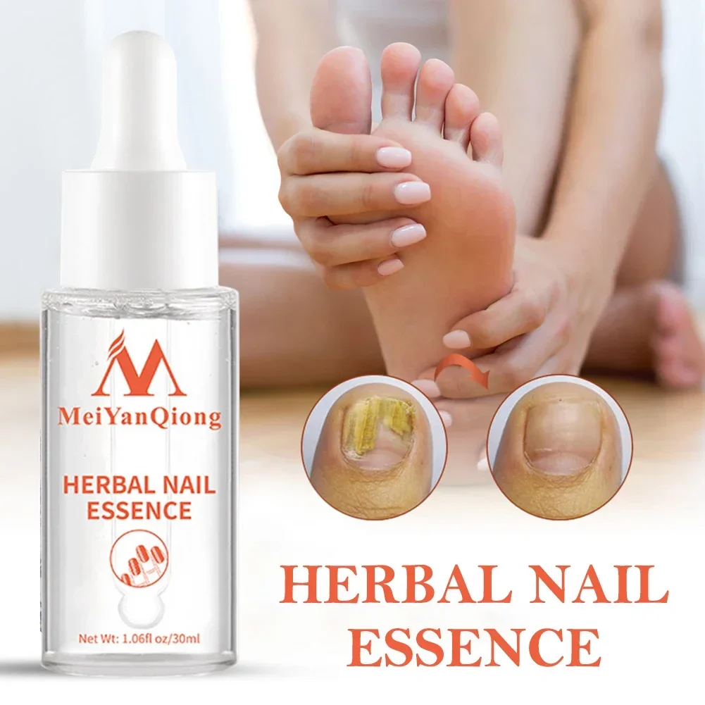 Toenail Repair Essence Anti Infection Nail Fungus Treatments Essence Feet Onychomycosis Repair Supply Unisex