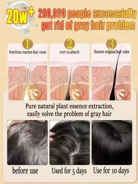 R&eacute;soudre les probl&egrave;mes de cheveux blancs &agrave; partir de la racine des cheveux pour restaurer la couleur naturelle des