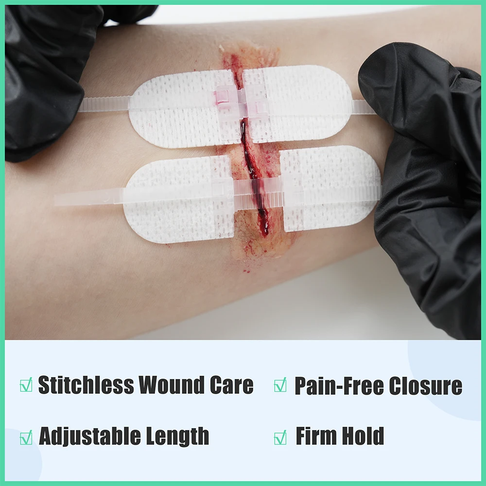 RHINO RESCUE Wound Closure Strips 6pcs