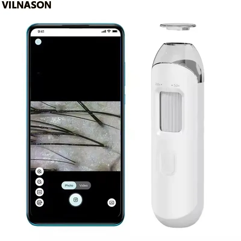 Electron Scalp Detection Pore Magnifier For Face Digital Microscope Camera Dermatoscope Skin Analyzer Machine Head Skin Analysis