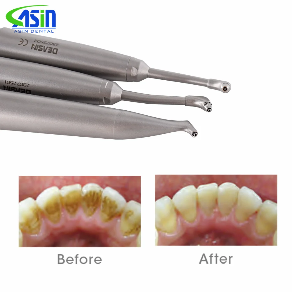 Dental-Luftpolierer-Düsenspitzen Ersatzteile Sandstrahler Prophylaxe-Polierer Zubehör