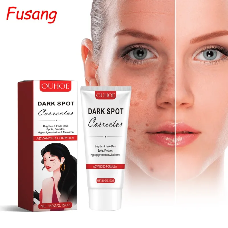 

Facial Quickly Brightening Cream Melasma Removal Emulsion Fade Chloasma Lightening Cream For Dull Skin Women Moisturize Products
