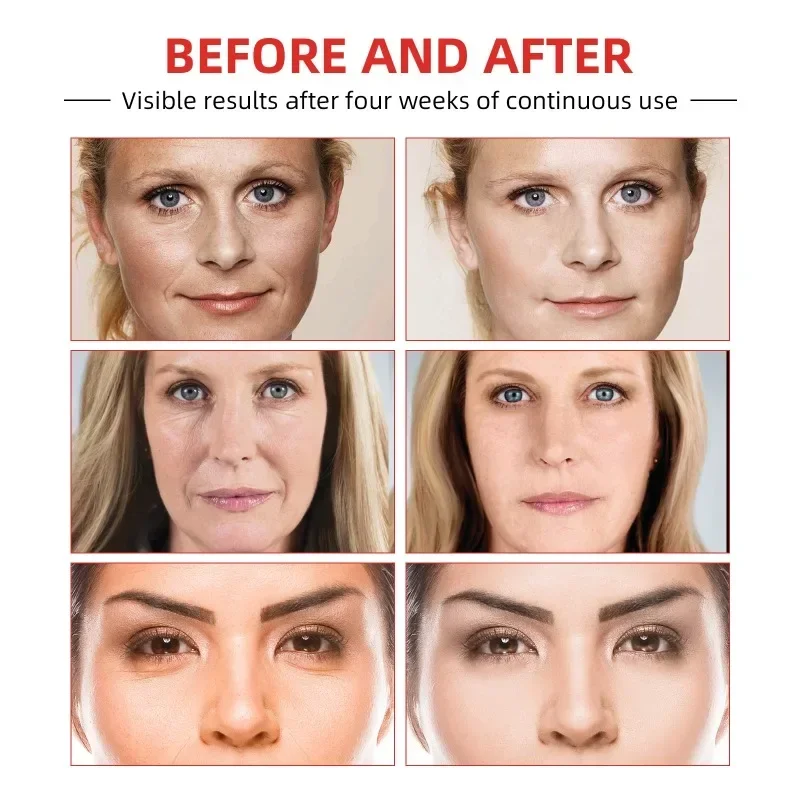 Instant anti-wrinkle cream firming lifting remove fine lines fade nasolabial folds Anti-aging Moisturizing Brighten Facial Skin
