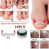 10PCS Ingrown Toe Nail Treatment Ingrown Toenail Correction Tool Elastic Patch Sticker Straightening Clip Brace Pedicure Tools 1