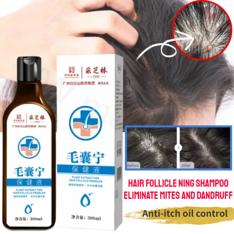 

300ml Repair Oily Head Remove Scalp Mites Control Oil Remove Dandruff Relieve Itching Herbal Essence Folliculitis Shampoo