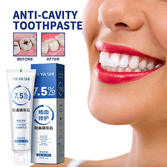 Pasta de dientes para prevención caries, tratamiento para blanquear los dientes, eliminacion dientes amarilla