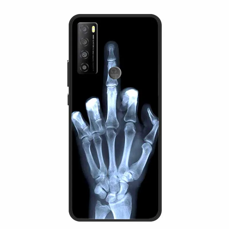 Fashion Soft TPU Silicone Back Cover Phone Case Bumper  Coque