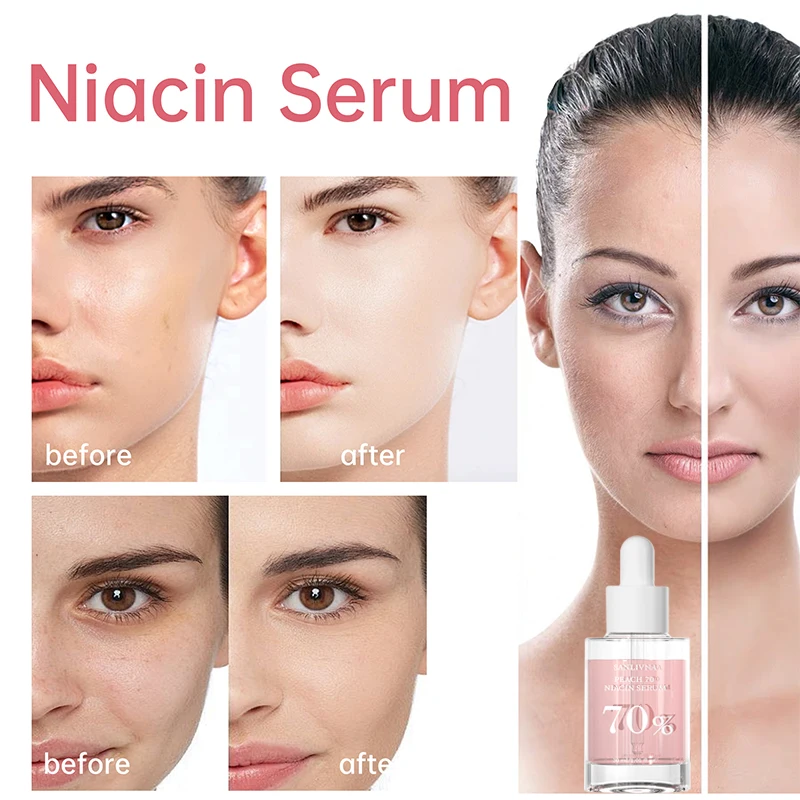 Korean Facial Serum Niacinamide Brighten Skin Rejuvenating Hydrating Whitening Lotion Fade Melasma Fine Lines Skin Care Essence