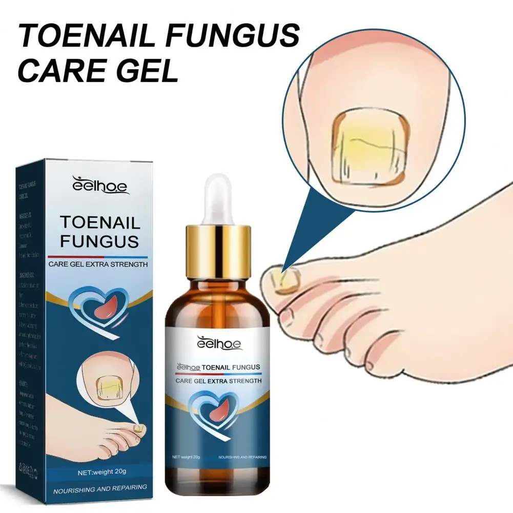 

20ml Nail Repair Oil Mild Toenail Repair Oil Non-Irritating Practical Renew Foot Yellow Cracked Nails Treatment Foot Care