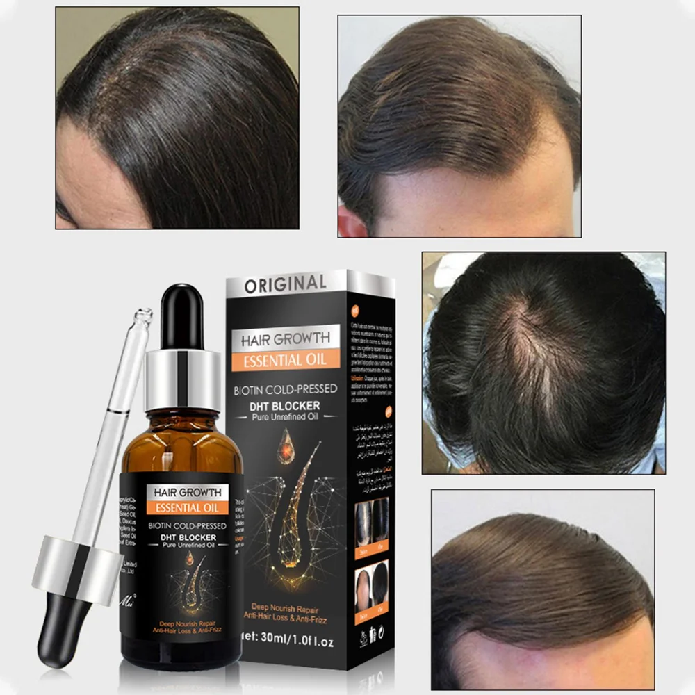 Hair Growth Essential Oil Biotin Cold-Pressed DHT Blocker Hair Growth Shampoo Anti-Hair Loss Conditioner Accessories hair growth serum hair growth spray hair care oil hair growth cream hair growth shampoo set